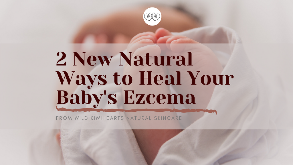 2 New Natural Ways to Heal Your Baby's Ezcema